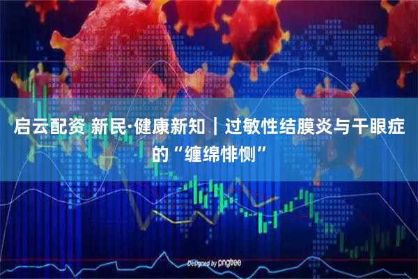 启云配资 新民·健康新知｜过敏性结膜炎与干眼症的“缠绵悱恻”